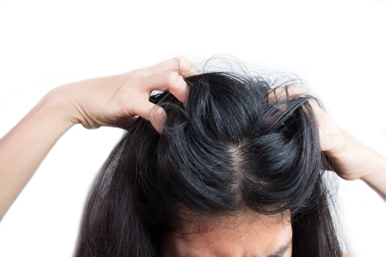 Close-Up Of Woman Scratching Head Against White Background