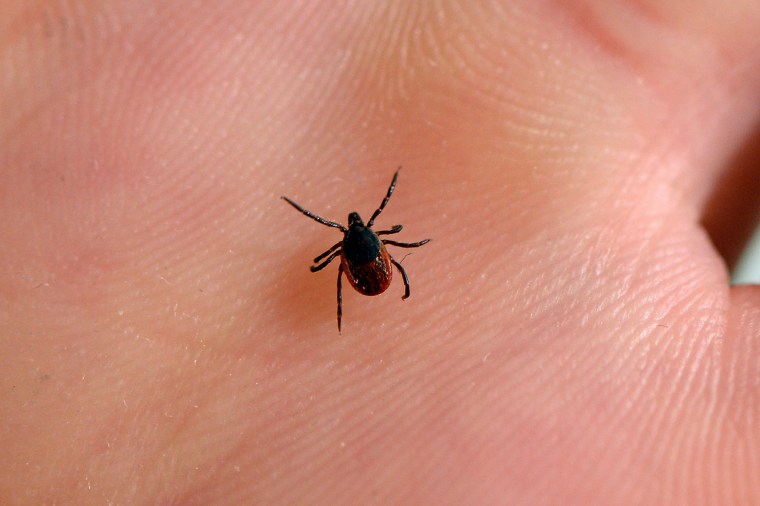 Image: Tick, Lyme Disease