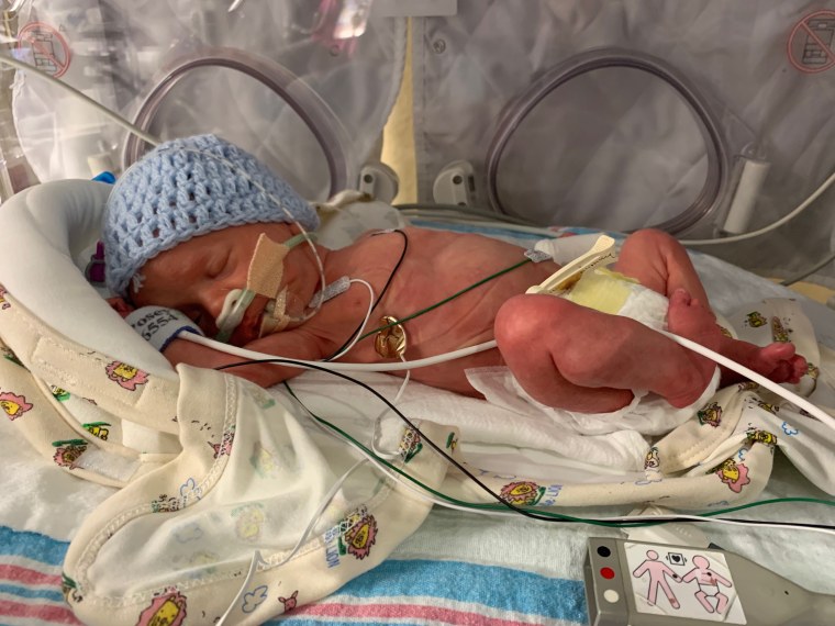 Florida dad Chris Askew's son, Dylan, was born 10 weeks premature and has been in the NICU for more than three weeks.