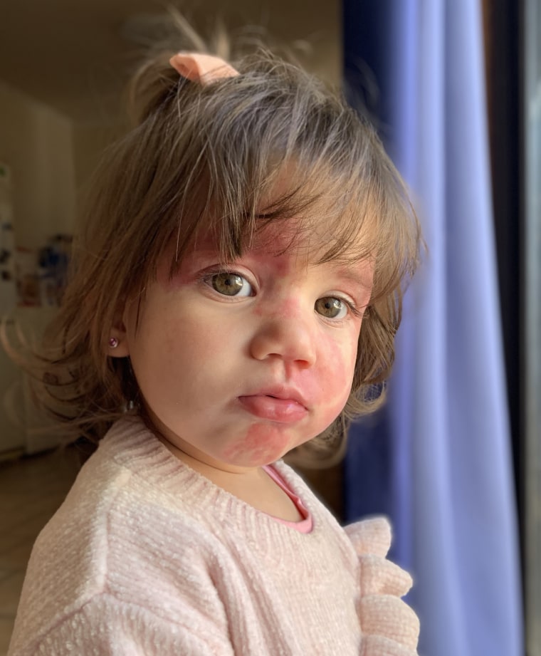 MUM OF BABY WITH PORT WINE STAIN HITS BACK AT BULLIES WHO CALLED HER DAUGHTER HIDEOUS AND A DEFECT - AND EVEN ASKED IF HER FACE HAD BEEN PUSHED ONTO A SKILLET