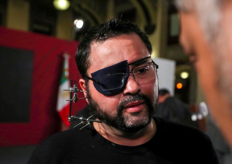 Image: Paul Velazquez, a video blogger wearing an eye patch and with metal surgical pins in his face, listens to Mexican President Andres Manuel Lopez Obrador at a news conference in Mexico City on Feb. 5, 2020.