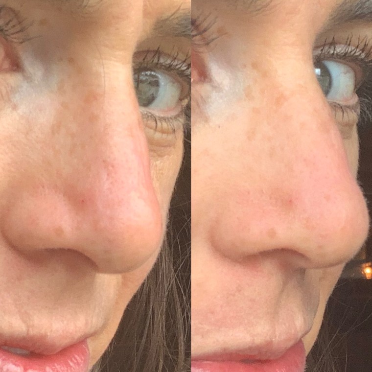 Before (left) and after (right) applying the Maybelline Baby Skin Instant Pore Eraser to my nose