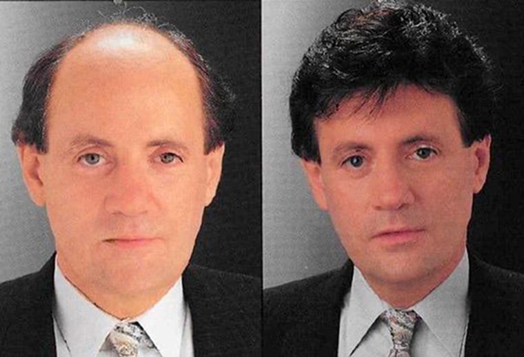 Sy Sperling, in a hair before and after. Sperling was the founder of "Hair Club for Men."