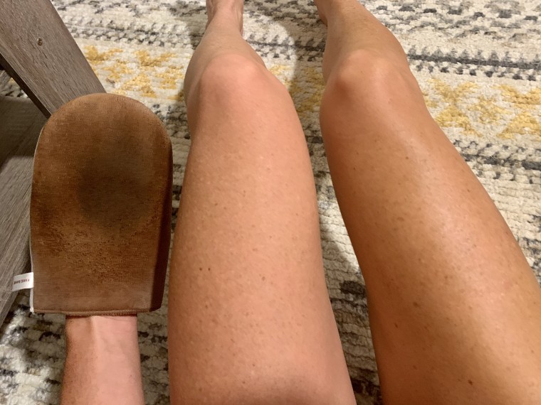 Fake tan fail leaves teenager housebound for a week