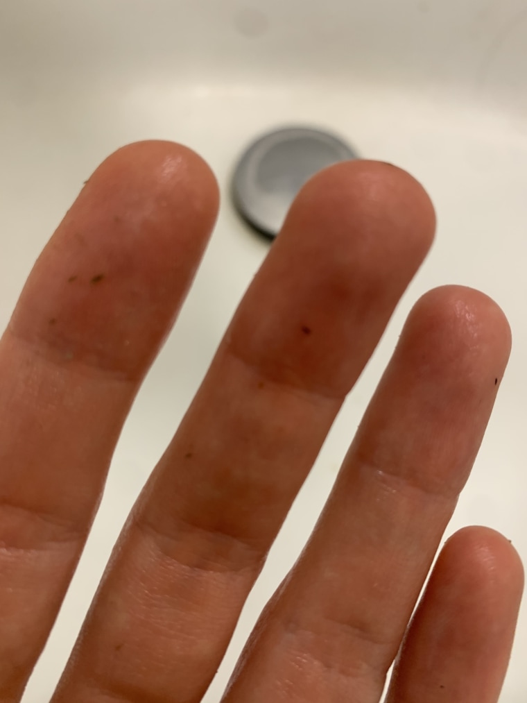 The dead skin that comes off after using ExfoliKate