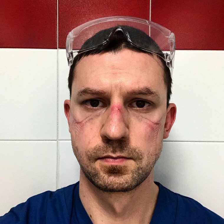 Italian Medical Worker Shares Selfie After A 13 Hour Shift