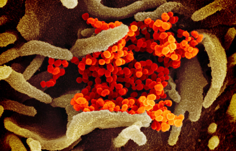 Image: A scanning electron microscope image of the virus that causes COVID-19 isolated from a patient in the U.S.