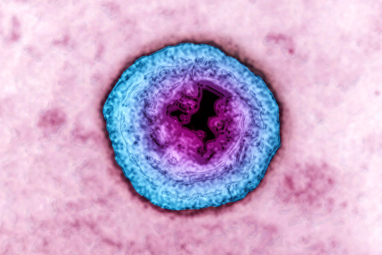 Image: The herpes simplex virus that causes cold sores and genital herpes.