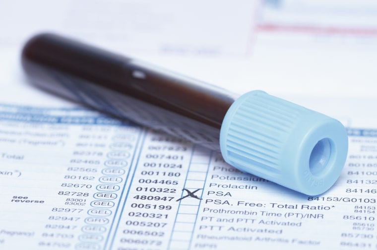 Psa Testing Deadly Prostate Cancer Cases Rising As Screening Declines