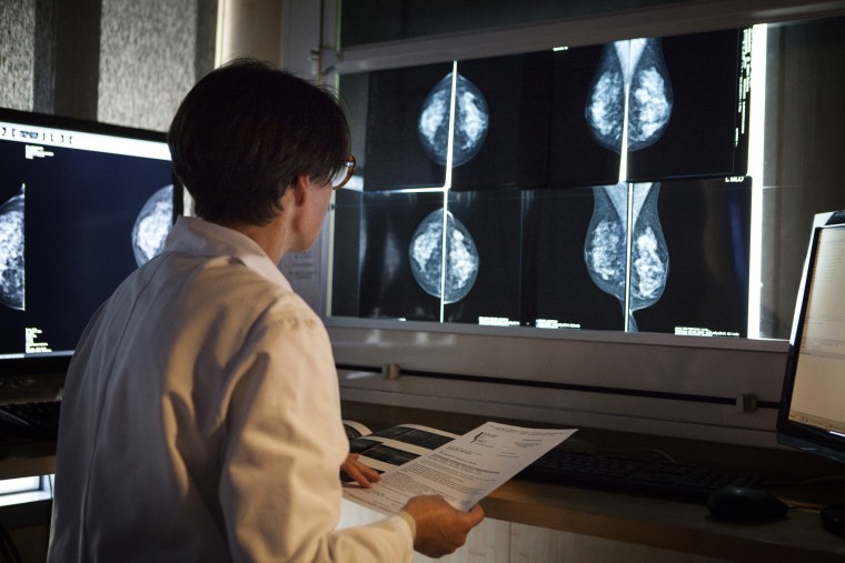 Image: A radiologist looks mammograms