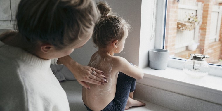 Female Caucasian child with chicken pox sat on the kitchen counter with her bare back to her mum as she gently rubs cooling cream on to her skin.