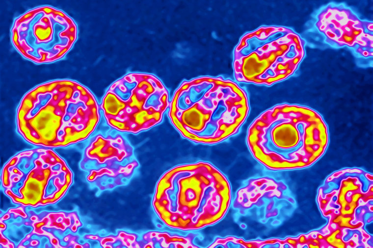 Image: Colorized electron microscope image of the HIV virus.