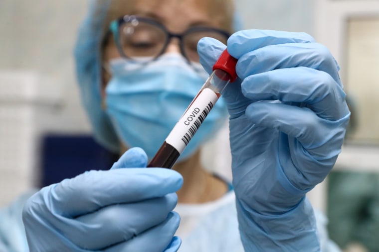 A healthcare worker holds a vial with a blood sample while performing antibody tests for SARS-CoV-2 at the SklifLab laboratory of the Sklifosovsky Research Institute of Emergency Care on May 29, 2020, in Moscow.