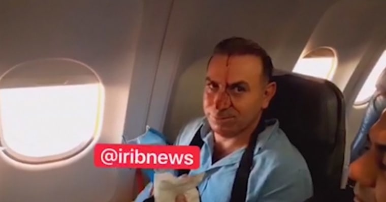 Image: Close-up of a passenger sitting by window with blood on his face in a screenshot from footage purportedly shot by a reporter for Iranian state TV.