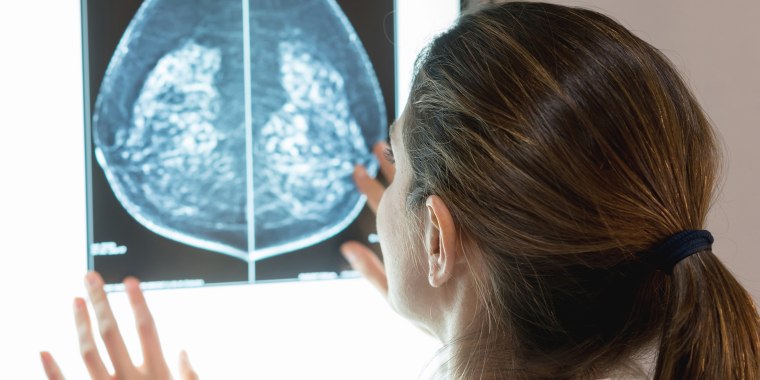 3 lifestyle changes to make right now to reduce your risk of breast cancer