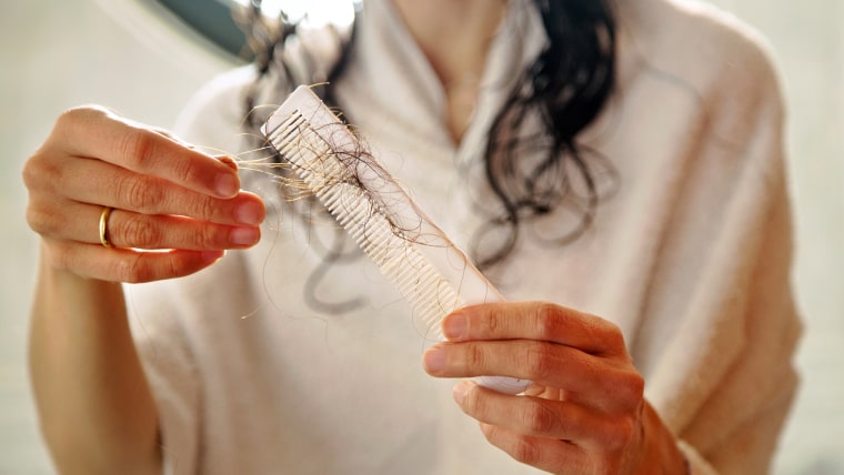 Hair loss.Hands holding a comb full of hair fallen