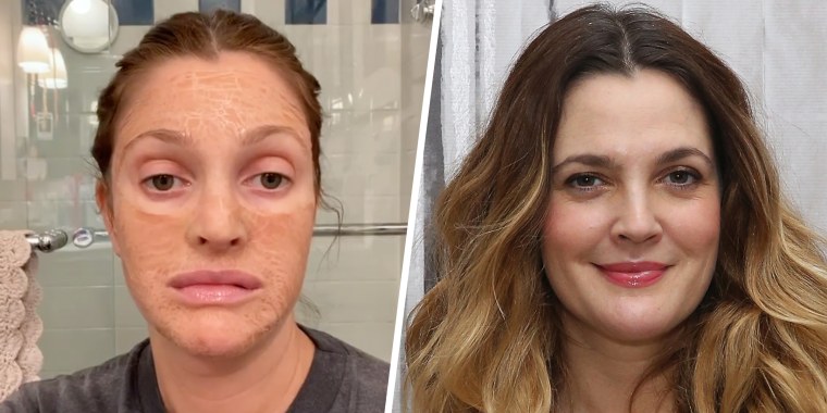 anti aging facial before and after