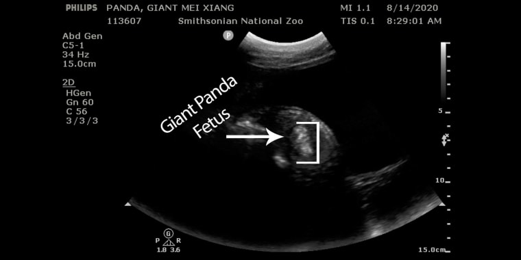 Veterinarians at the Smithsonian's National Zoo detected tissue consistent with fetal development during giant panda Mei Xiang's ultrasound this morning, Aug. 14.