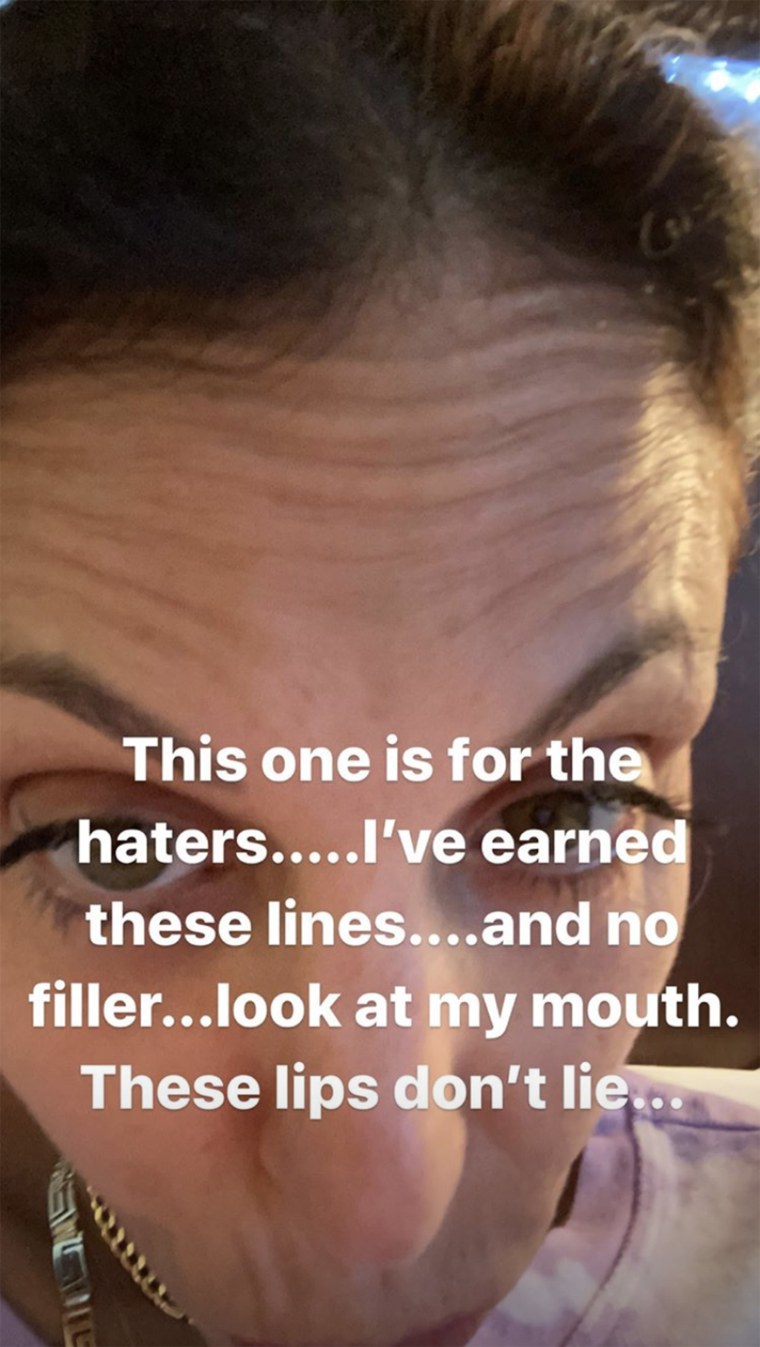 Frankel shared an unfiltered photo in her Instagram story in response to "the haters."