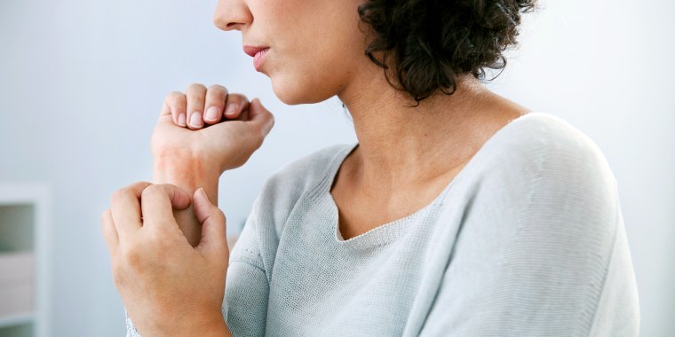 Woman itching eczema rash on wrist
