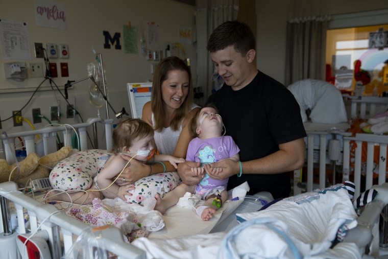 Following their surgery, the twins stayed at the hospital for a month.