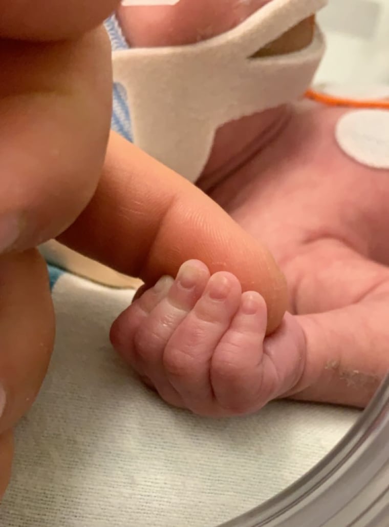 Salmonese's twins were born several weeks premature after having surgery in-utero.