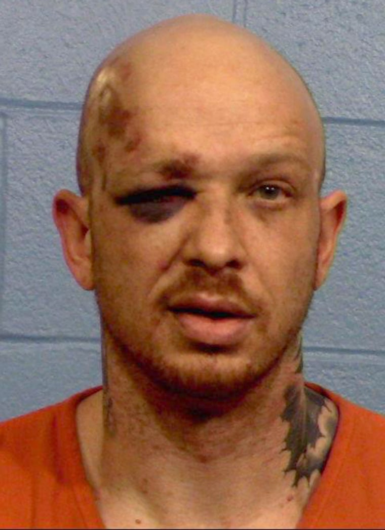 Image: Injuries sustained by Ramsey Mitchell after his encounter with Williamson County Sheriff's Deputies in June 2019.