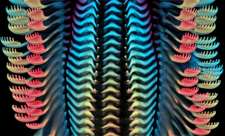 Tongue (radula) of a freshwater snail.