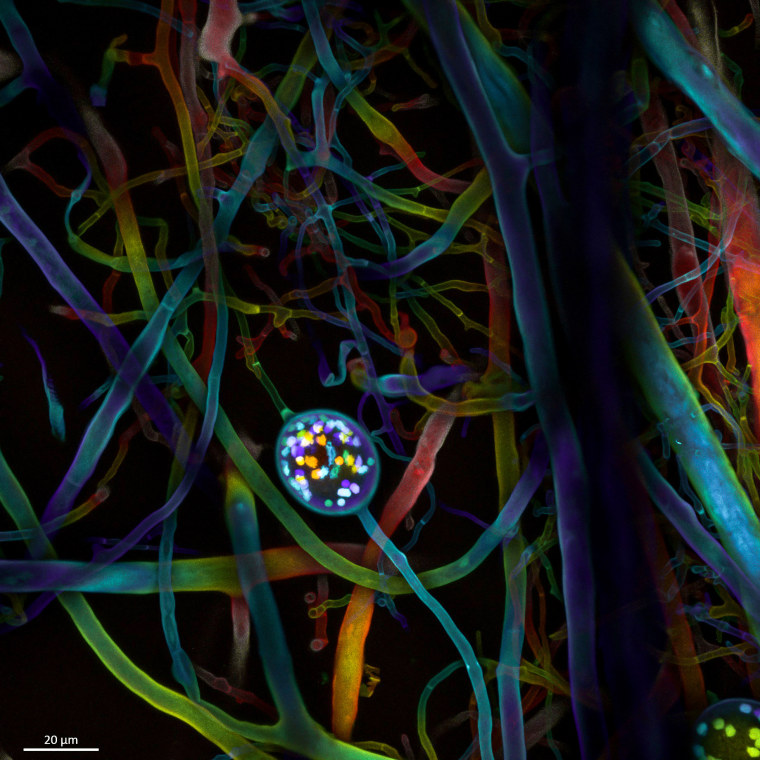 Multi-nucleate spores and hyphae of a soil fungus (arbuscular mycorrhizal fungus).