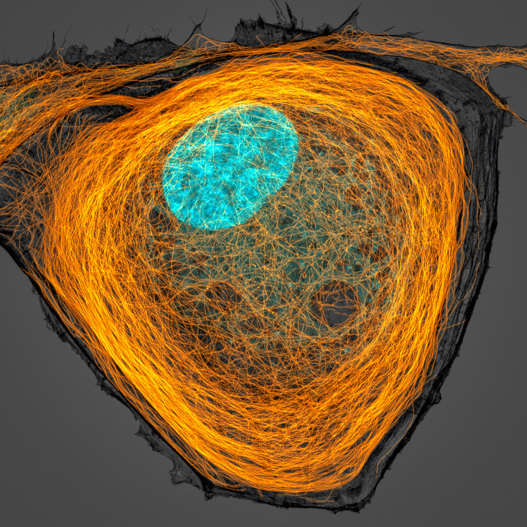 Microtubules (orange) inside a cell. Nucleus is shown in cyan.
