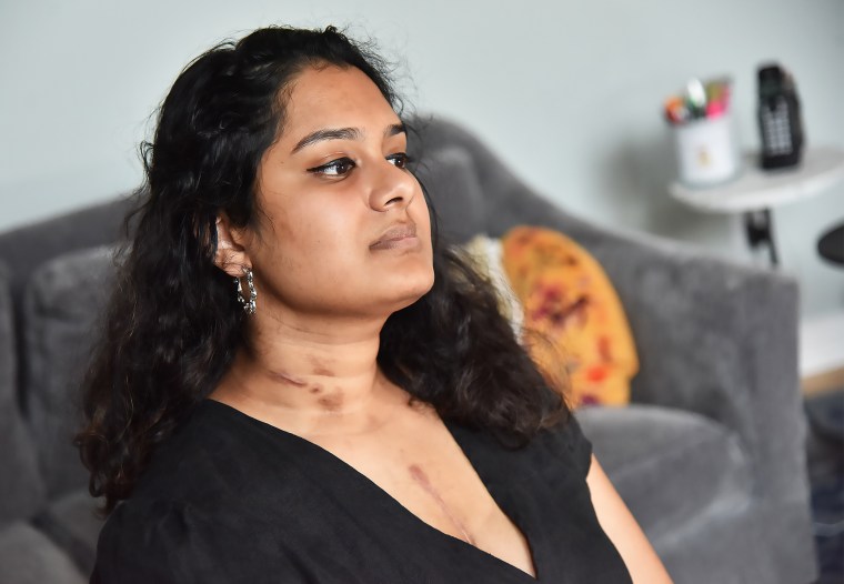 Months after having COVID-19 Ramya Yeleti became very sick as her heart was starting to fail. Doctors believe that COVID-19 attacked her heart, weakening it. 