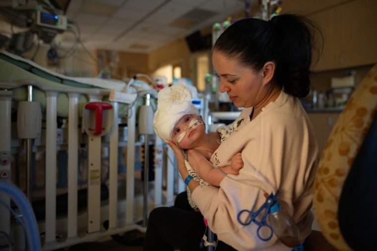 Liliya Miroshnik is grateful for the surgical team that separated her 9-month-old twin girls.