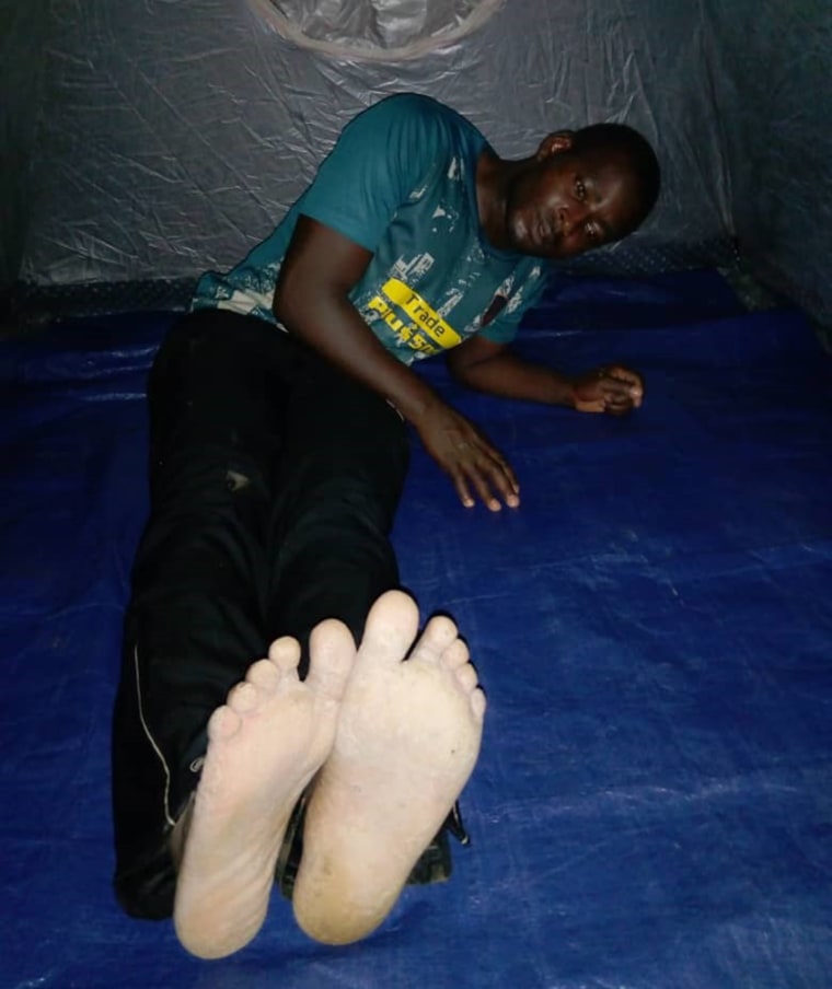 Image; Justice Bantar after he was beaten on the bottom of the feet in Cameroon.