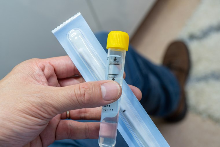 Man holding a sample collection tube for Chlamydia testing