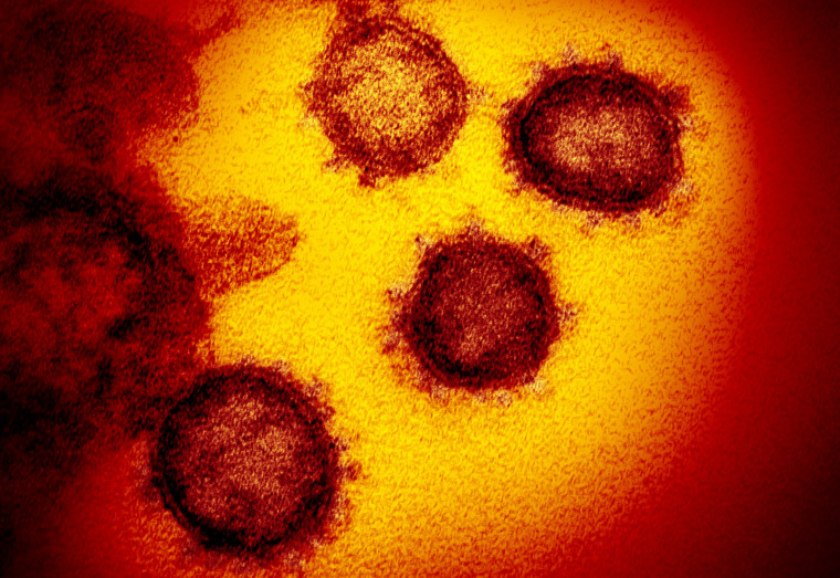 Image: An electron microscope image shows Novel Coronavirus SARS-CoV-2. Also known as 2019-nCoV, the virus causes COVID-19. The sample was isolated from a patient in the U.S.