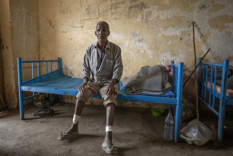 Image: Guesh Tesla, 54-year-old carpenter and Tigrayan survivor from Rawyan, Ethiopia, shows wounds from sticks on his legs, inside a shelter, at the Hamdeyat Transition Center near the Sudan-Ethiopia border, eastern Sudan