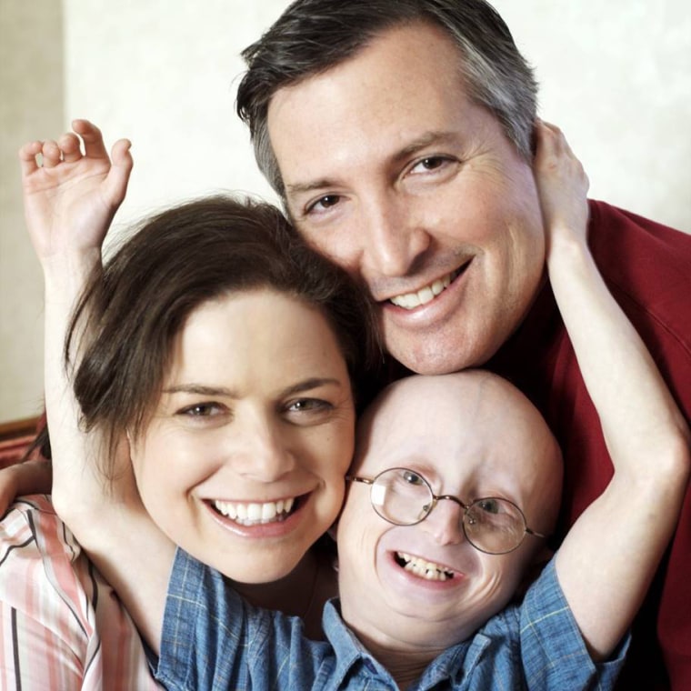 Dr. Leslie Gordon and Dr. Scott Berns are pictured with their son, Sam Berns, who had progeria and died in 2014 at age 17.