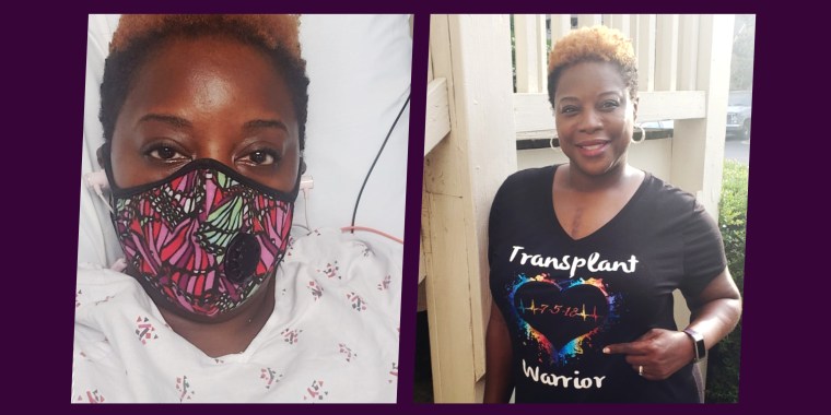 Split image of woman before and after transplant