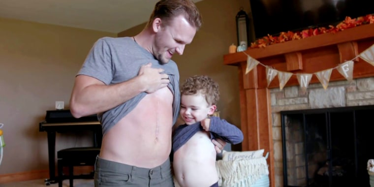 Grant and Brooks showed off their scars from the lifesaving transplant. 
