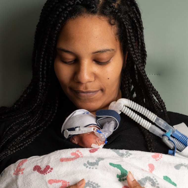 Helen Woldemichael delivered her daughter Amari at 25 weeks gestation. 
