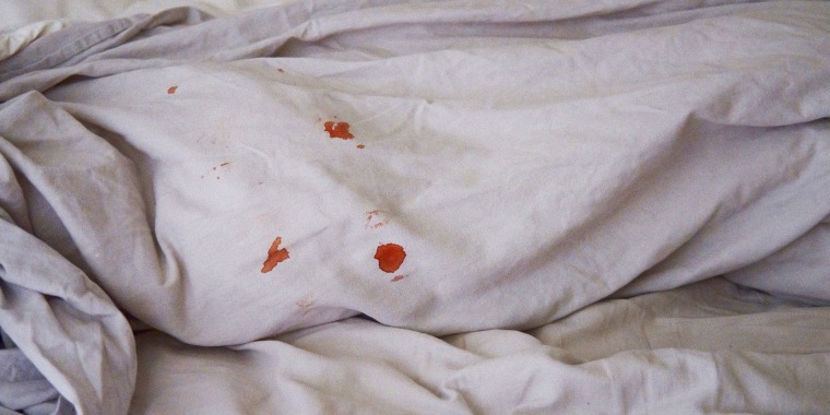 Blood spots on grey linen bedding