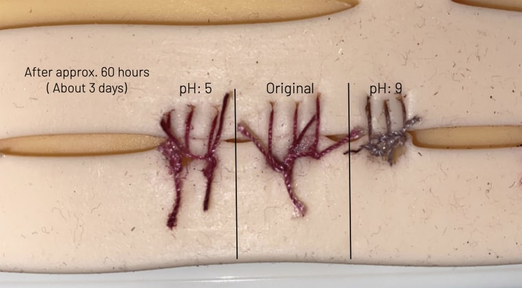 17-year-old creates color-changing sutures with beet juice to detect infection