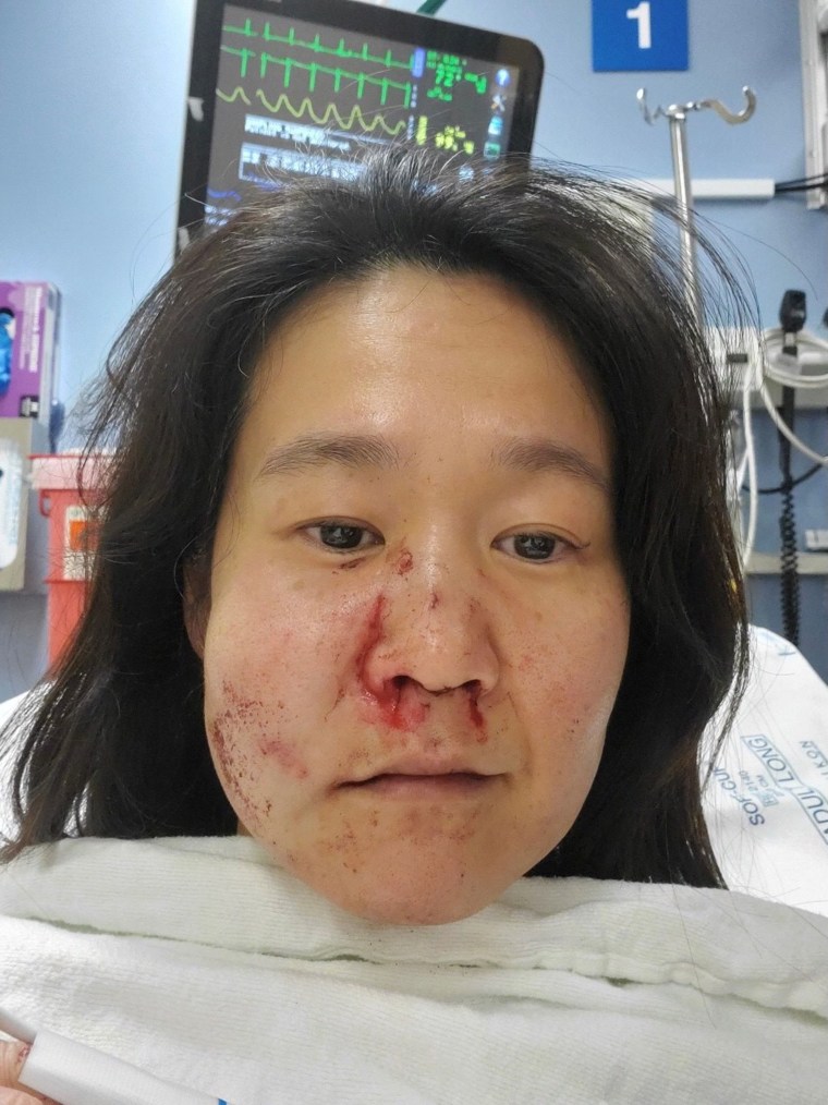 Noriko Nasu post-attack in hospital bed with facial injuries