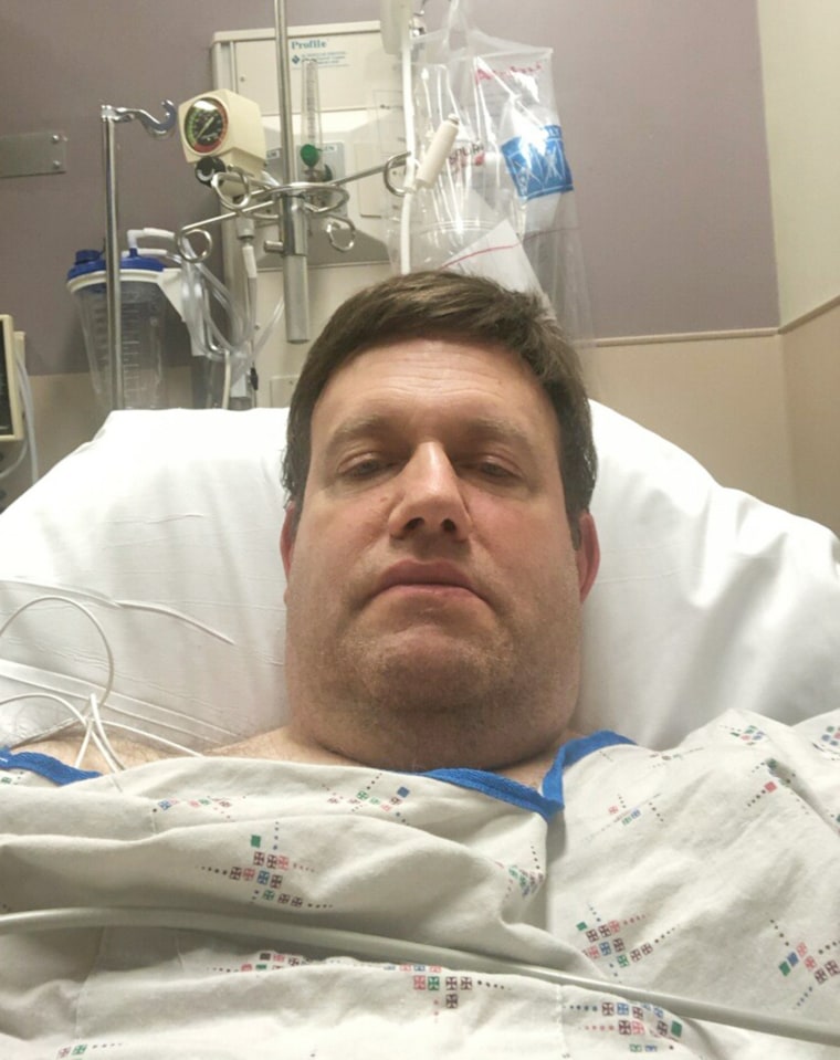 After Luntz had a stroke in January 2020, he decided to lose weight.