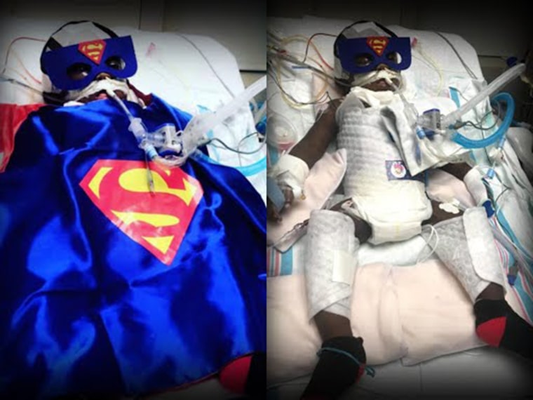 After Torin's heart stopped during a procedure, he had to undergo several surgeries to relieve pressure in his brain and had a stroke. Doctors didn't know if he'd ever wake. But Torin fought and the nurses dressed him like Superman to represent his strength. 