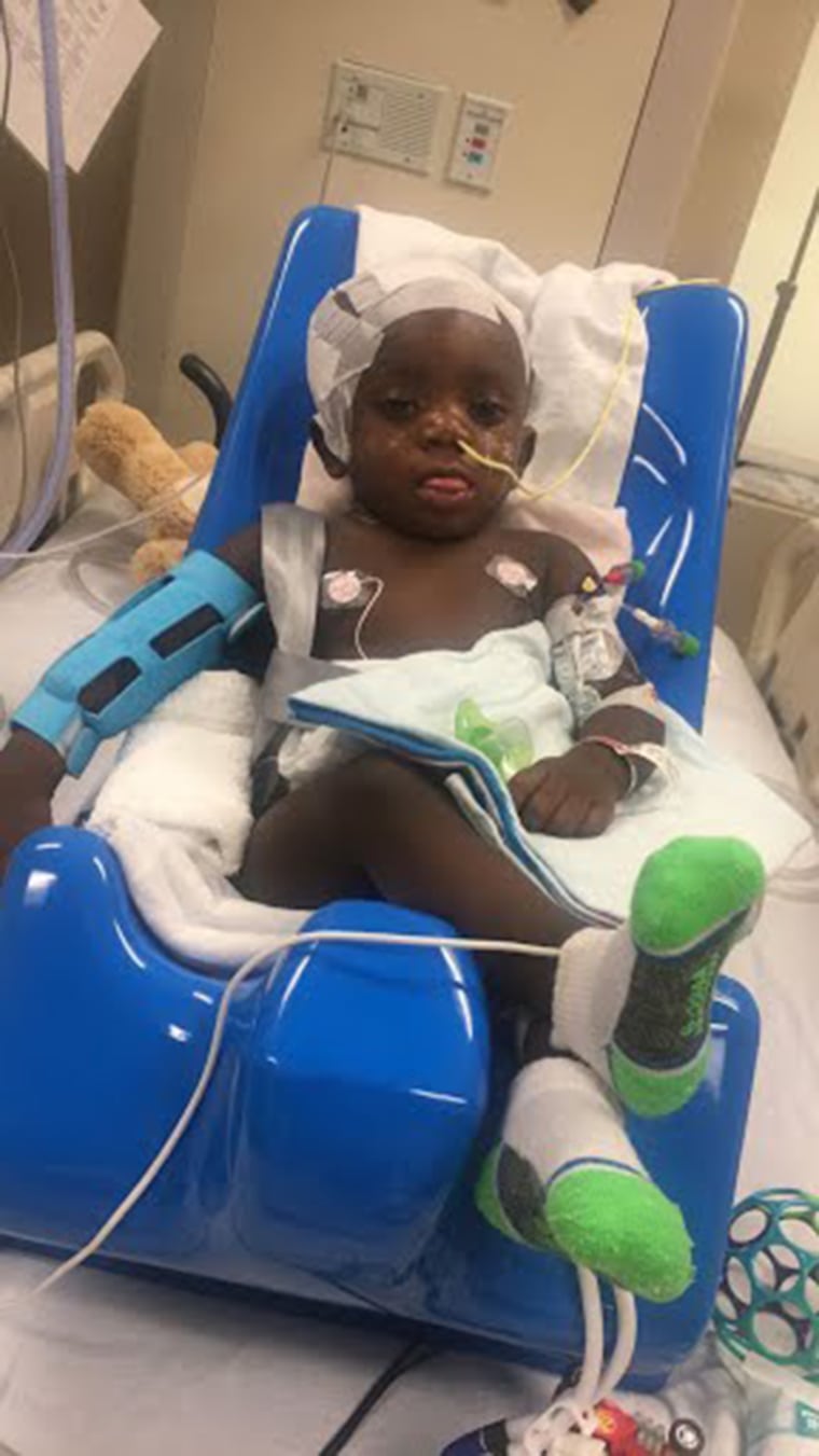 If Torin hadn't had the surgery to unblock his tear duct, doctors might not have found the rare heart defect he has. Experts say most times they are discovered in autopsies. 