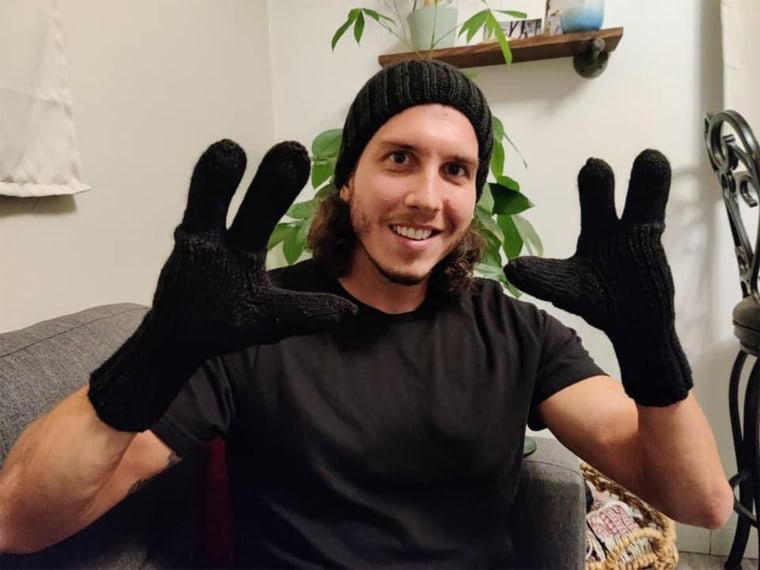 Barone now has gloves that perfectly fit his hands.