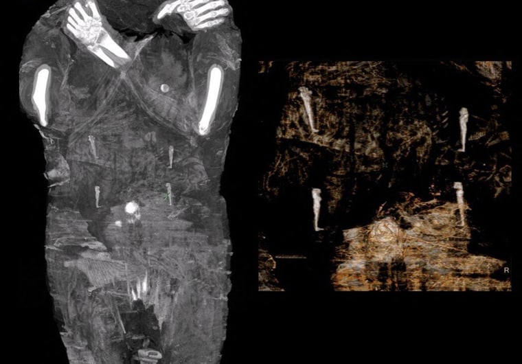 Image: POLAND-EGYPT-ARCHAEOLOGY-SCIENCE-TECHNOLOGY