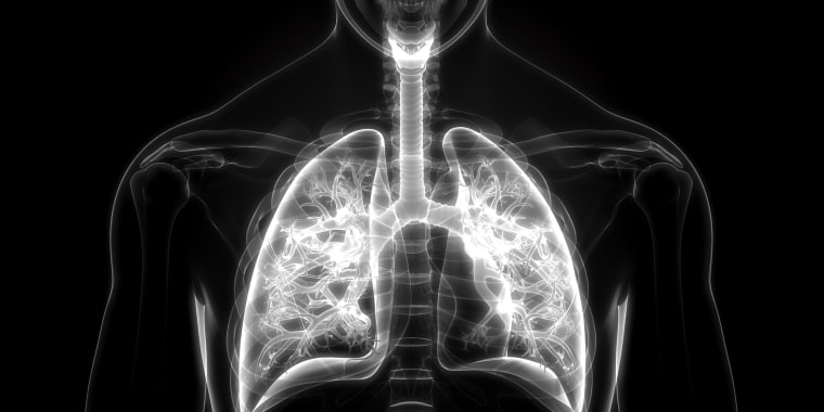 The medication is designed to target a gene mutation known as KRAS G12C that occurs in about 13% of non-small cell lung cancers (NSCLC), the most common type of lung cancer.