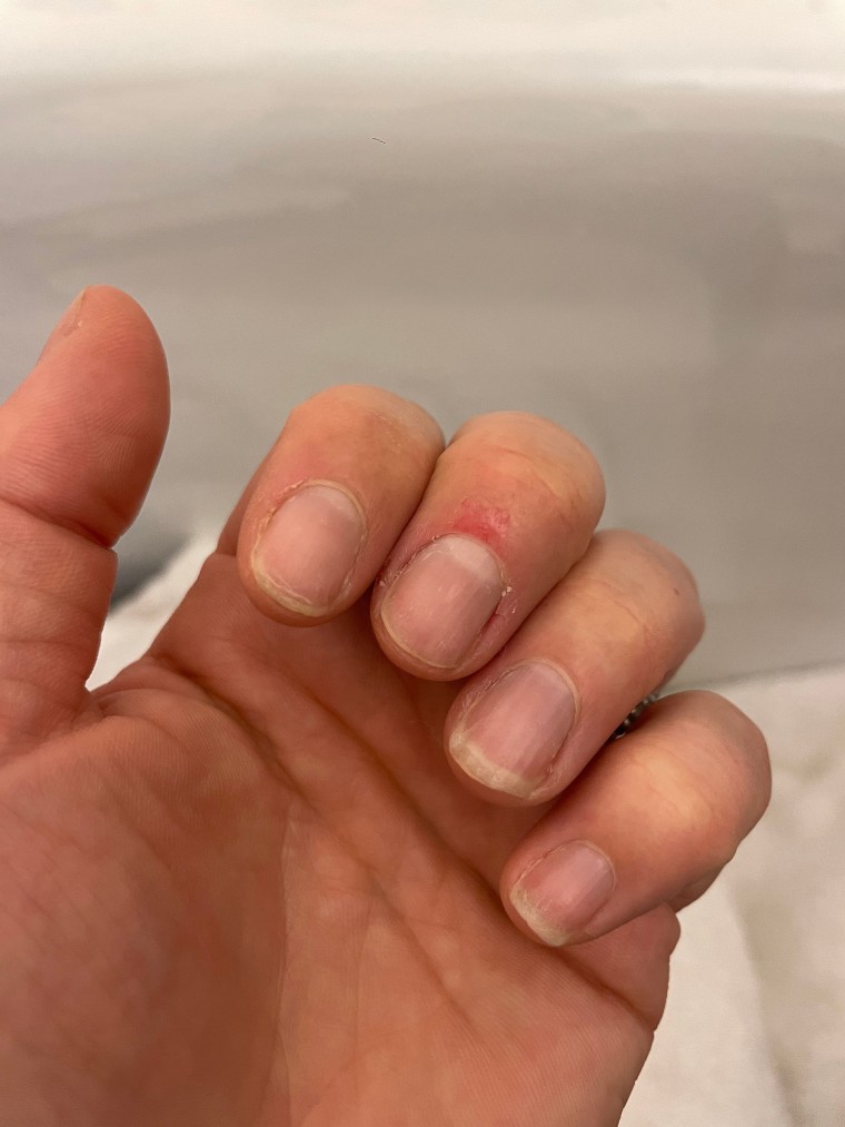 After some improvement in her habits, Dylan said she began biting her nails again after not being able to get a manicure in late May. 
